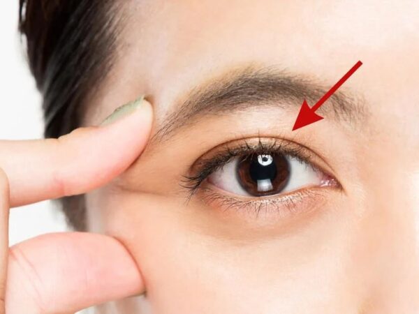 What You Should Know About Double Eyelid Surgery