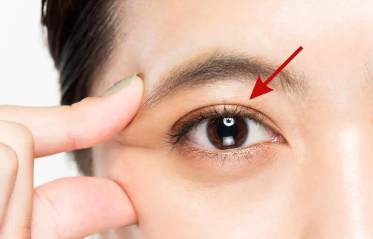 What You Should Know About Double Eyelid Surgery